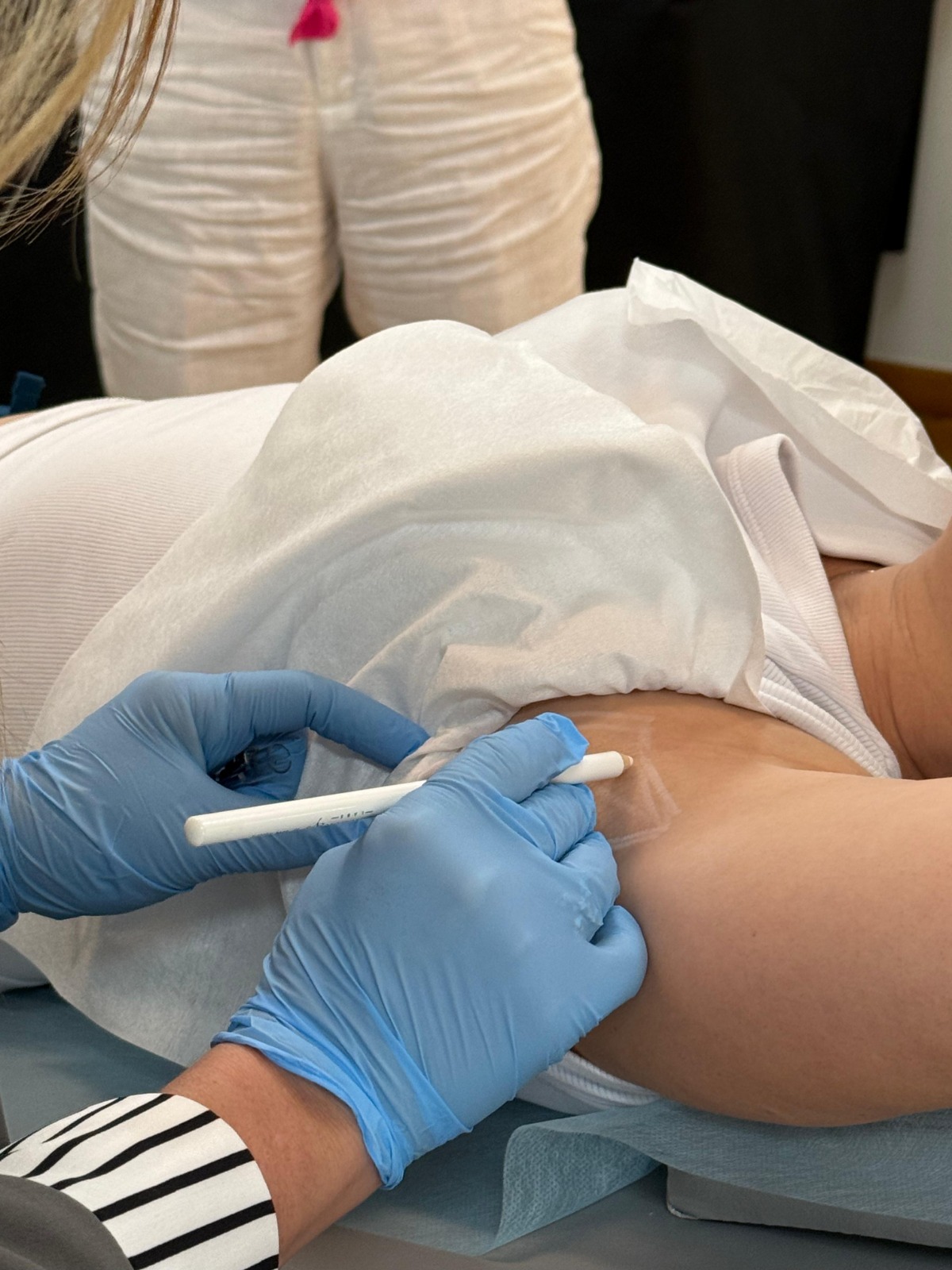 Celulitis y Piel de Naranja en Clínica Gottardo